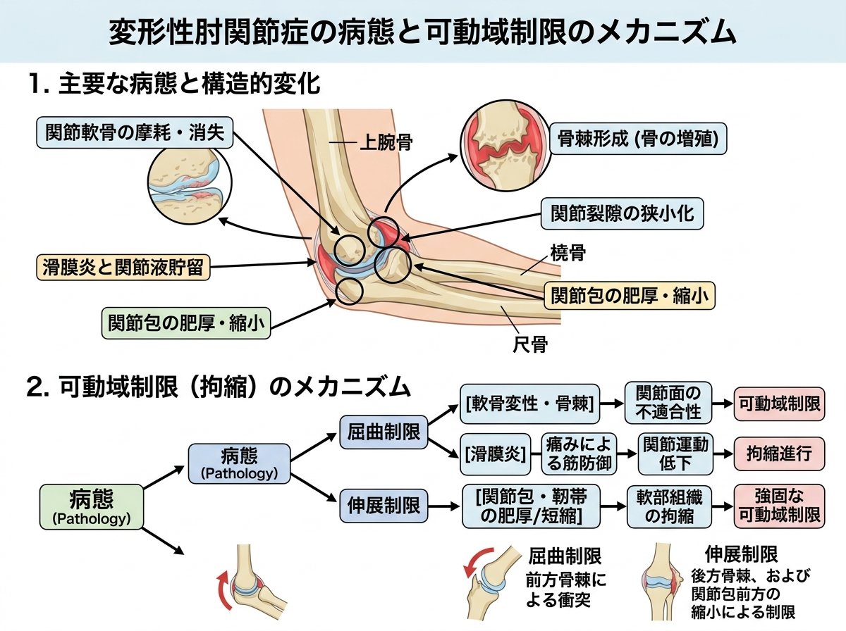 変形性肘関節症の病態と可動域制限のメカニズム