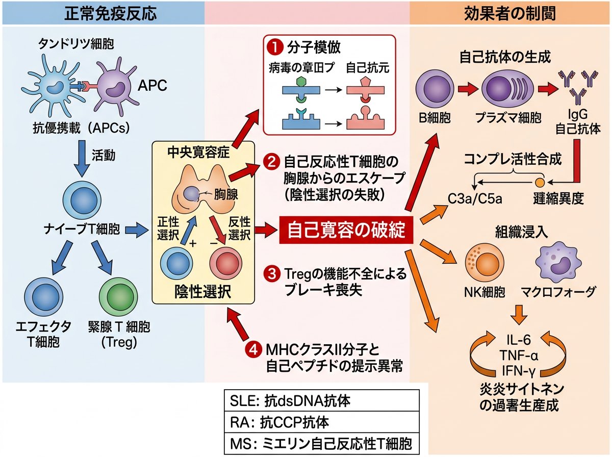 自己免疫疾患の発症メカニズムと免疫システムの異常