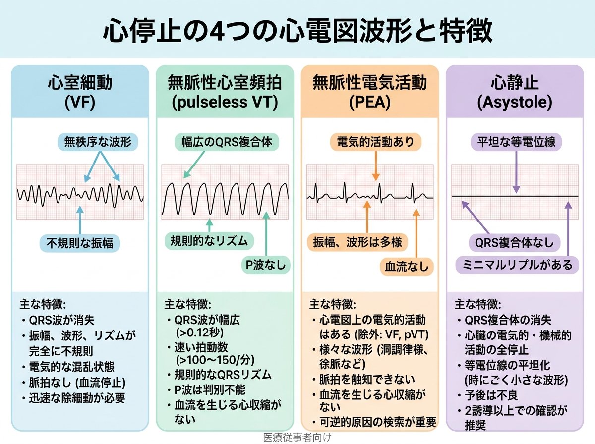 心停止の4つの心電図波形と特徴
