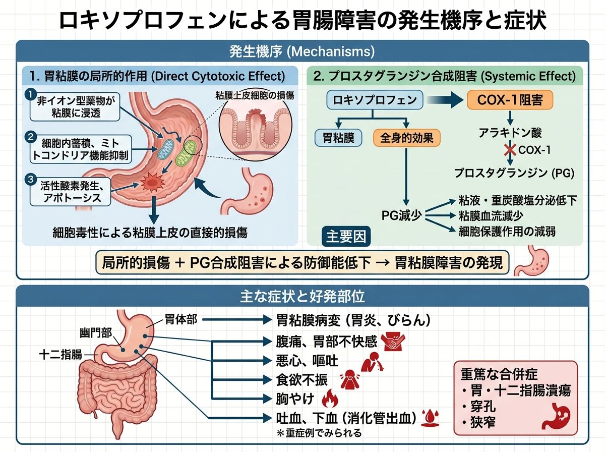 ロキソプロフェン胃腸障害の発生機序と症状