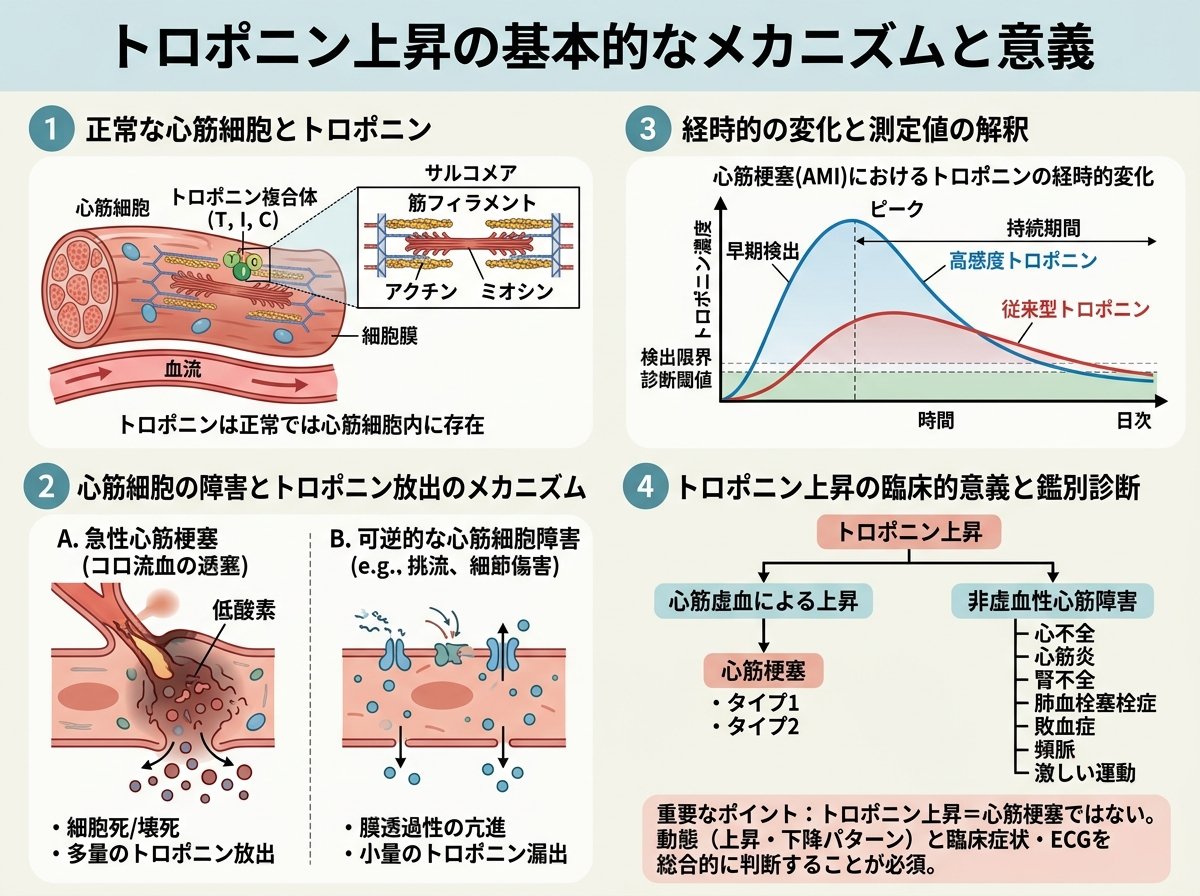 トロポニン上昇の基本的なメカニズムと意義